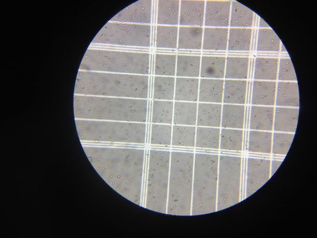Porn sperm microscope
