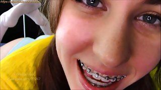 Laser recomended cute lean filipina teen braces with