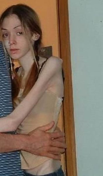 best of Anorexic tits skinny girl nice